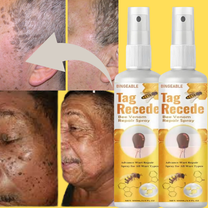 Tag Recede® – Spray Eliminador de Verrugas Despídete de las verrugas y marcas en la piel !